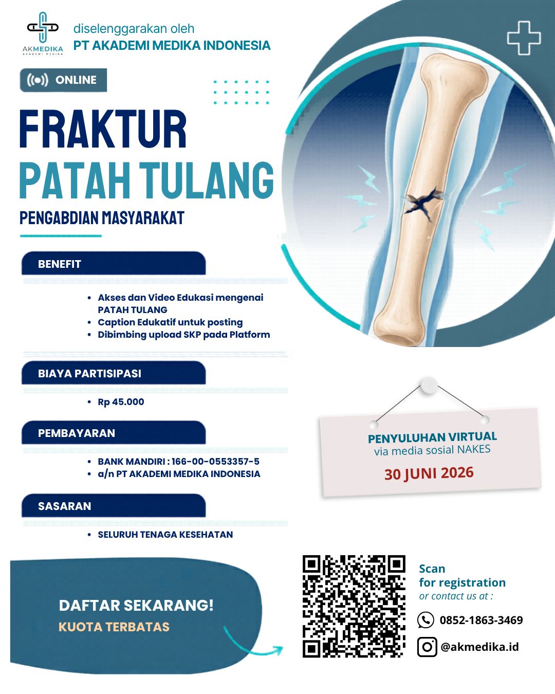Pengabdian Masyarakat Melalui Media Sosial - Fraktur (Patah Tulang)